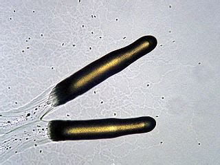 Dictyostelium discoideum - Eläinten kuningas ja sienet yhdessä kummallisella tavalla!