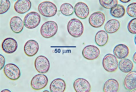  Isospora! A Tiny Parasite Making Big Waves in its Host's Digestive Tract